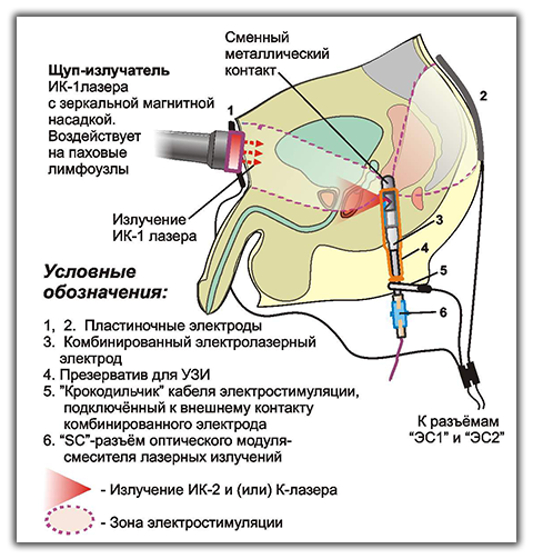 Раздатка фольксваген синхро Раздатка фольксваген синхро
